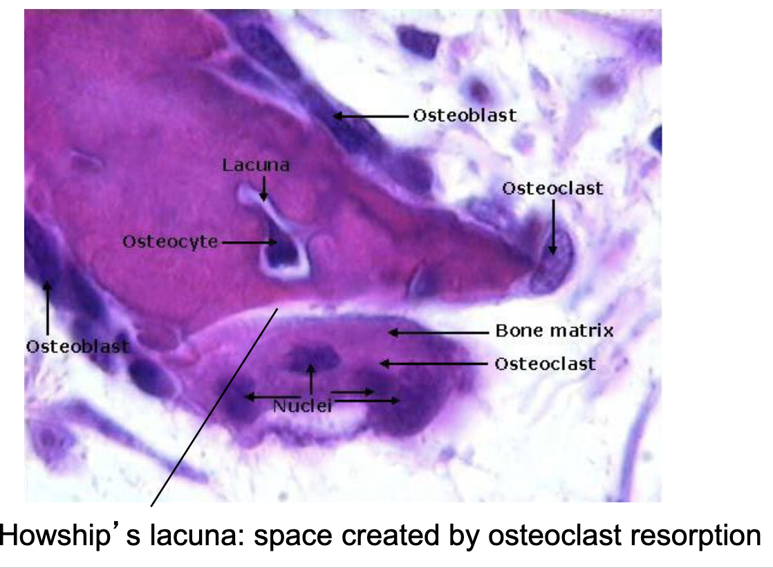 <p>Howship’s lacuna</p>