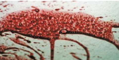 <p>What bloodstain pattern is this?</p>