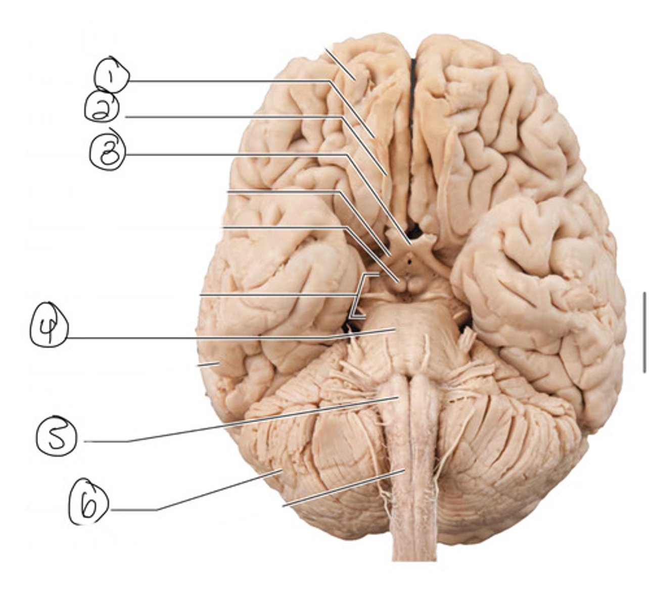 <p>What is number 5?</p>