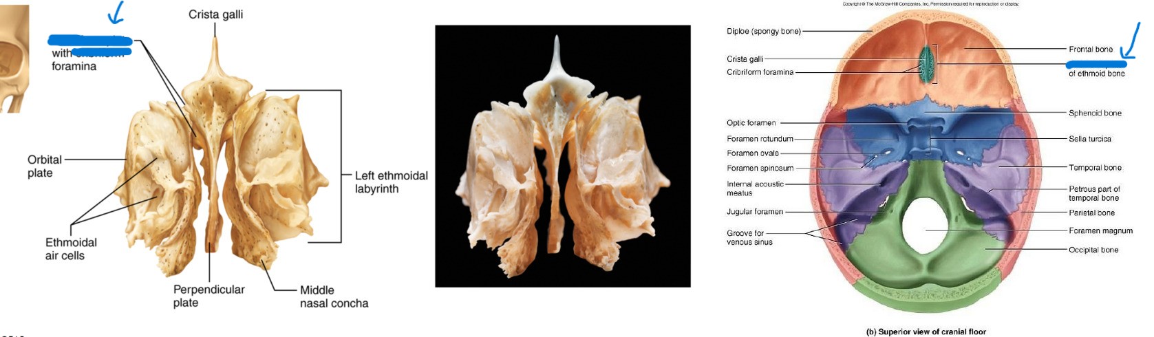 <p>What is this part of the ethmoid?</p>
