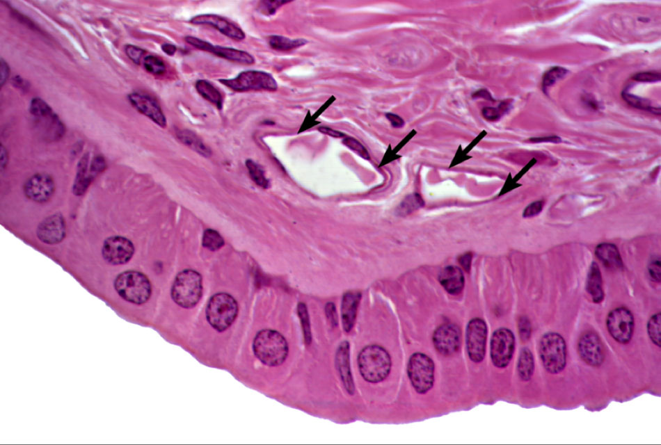 epithelial cells