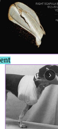 <p><span style="background-color: transparent;"><strong>Scapular Fractures</strong></span></p>