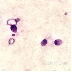 <p>Identify the sperm morphology.</p>