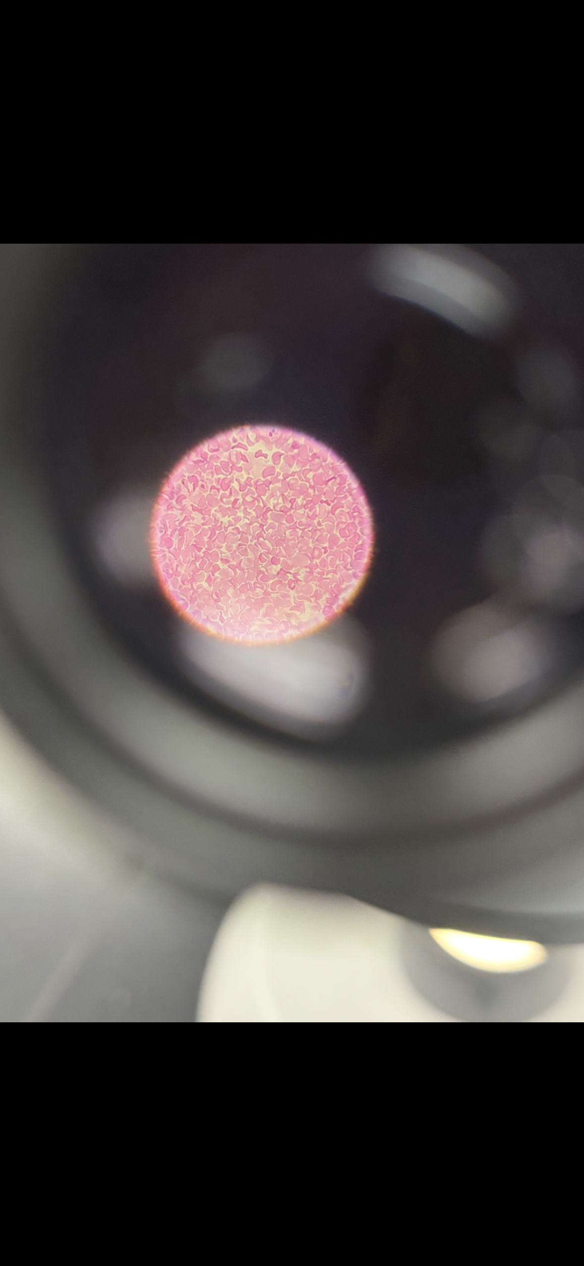 <p>Body location: lining the urinary bladder</p>