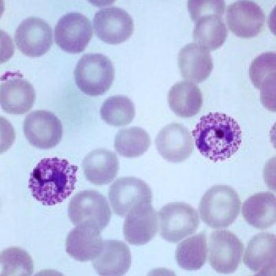 <p>in human</p><p>fever, regular synchronous paroxysms</p><p>SE Asia, South America, North Africa</p>
