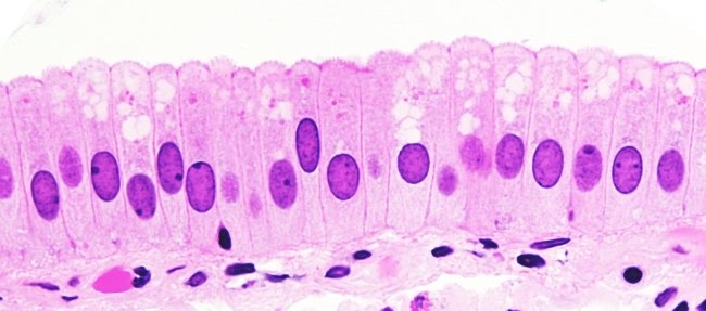 <p>Simple Columnar (Epithelial) </p>