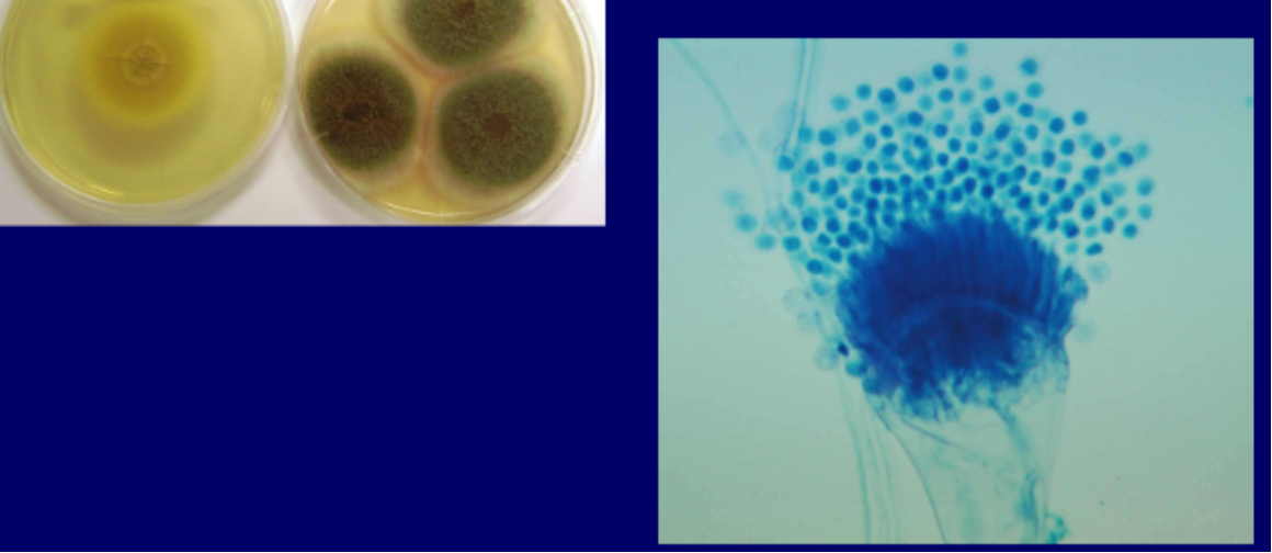 <p>micro: flask shaped vesicle (Bulbing branch) and spherical conidia, apex oriented phialides</p><p>macro: blue-green obverse, white gold reverse</p>