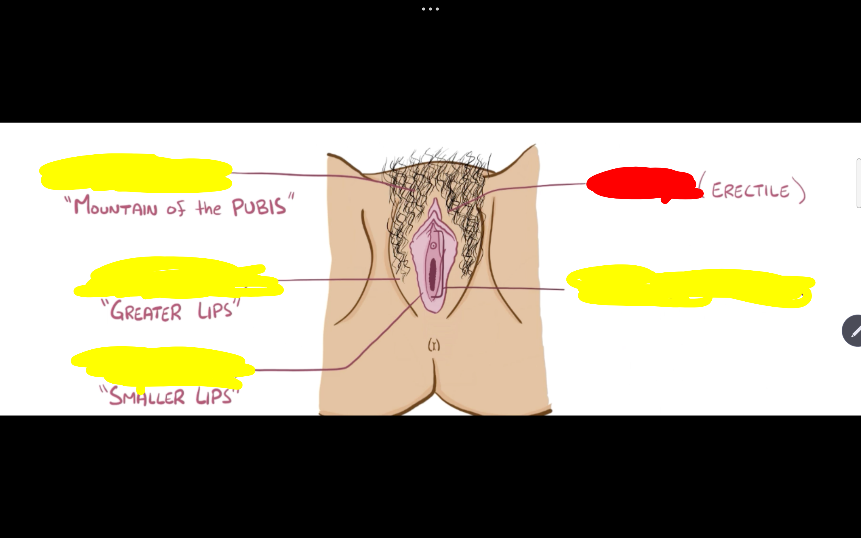 <p>Name the structure in red </p>