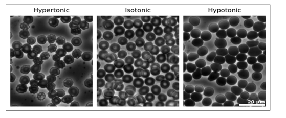 <p>-osmolarity describes solution (units of concentration)</p><p>-tonicity describes behavior of solution (unitless)</p><p>-hypoosmolar solutions are <strong>always </strong>hypotonic</p><p>-isoosmolar and hyperosmolar solutions may be hypo, iso, or hypertonic</p>