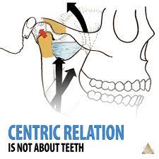<p>Centric Relation</p>