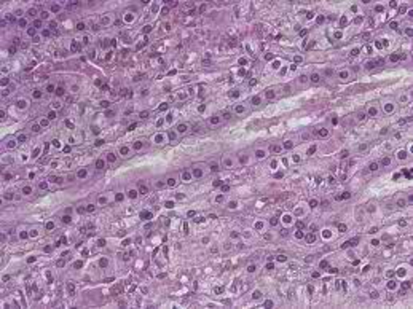 <p>Single layer of 'box' cells mainly found in the liver, thyroid, and kidney tubules for absorption and secretion.</p>