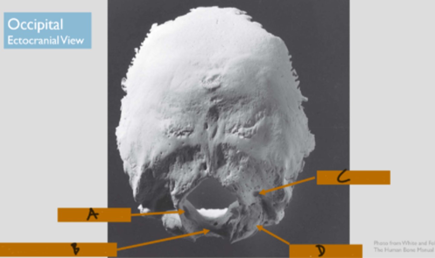 <p>hollowing on the endocranial surface of the basilar part of the occipital, the clivis (B in image)</p>