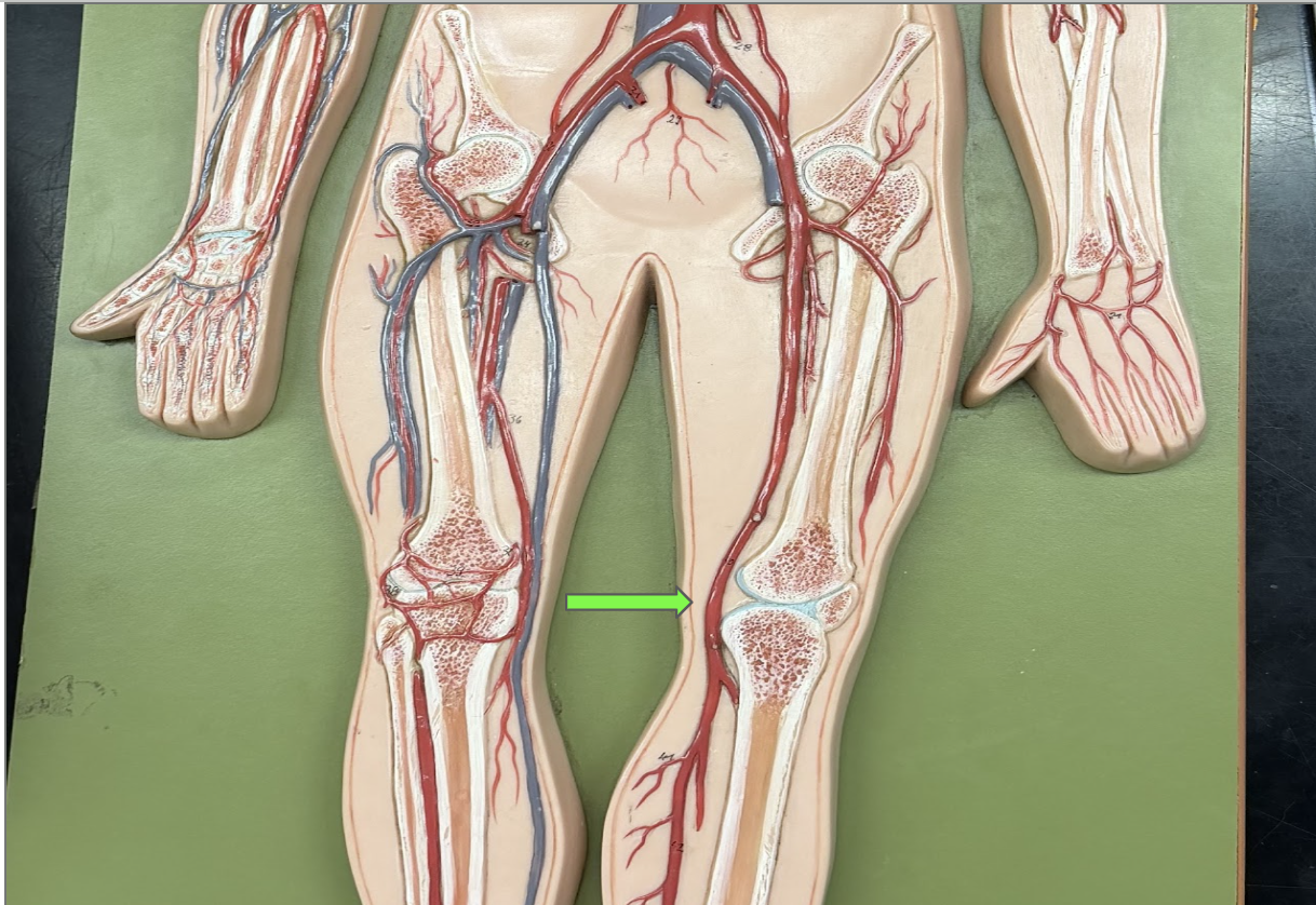 <p>What artery is this </p>