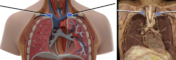 <p>drains blood from arm</p>