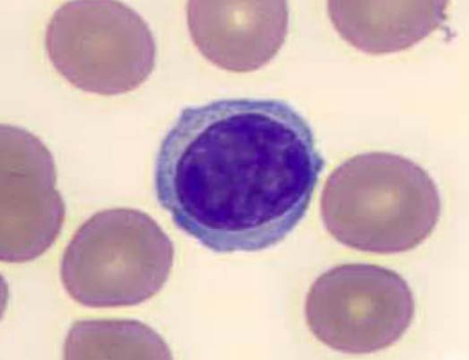 <p> Characterized by the large nucleus that occupies most of the cytoplasm </p><p> Increased in viral infection</p>
