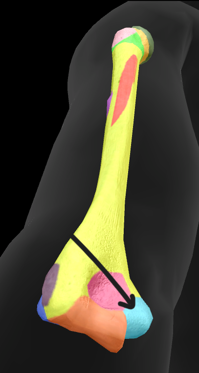 term image