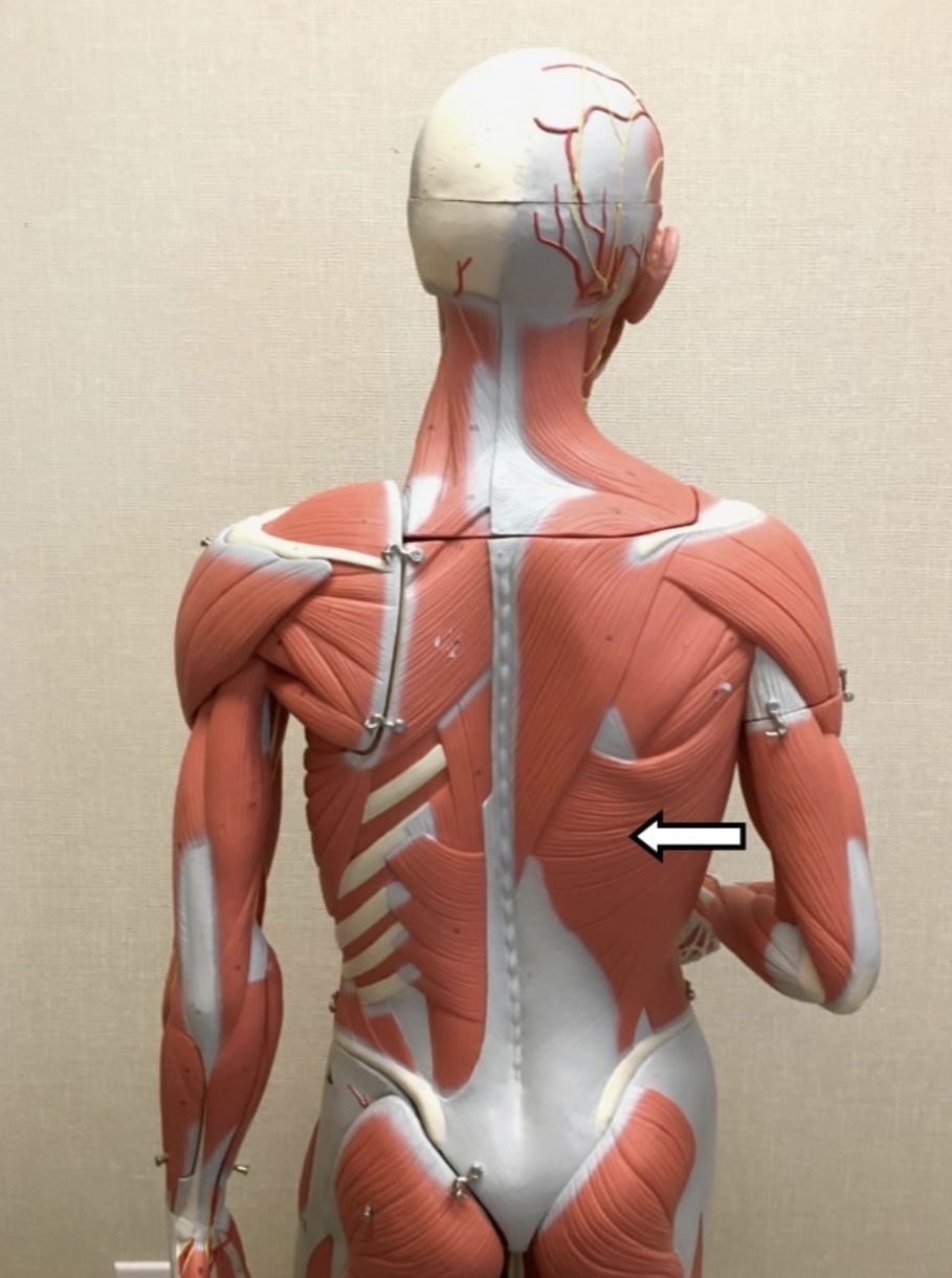 <p><span>Name the muscle labeled with the white arrow below.</span></p>