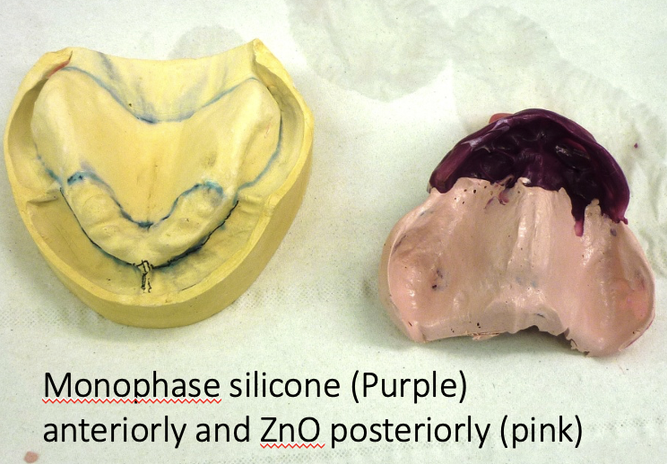 <ul><li><p>use different materials for different areas of the mouth for a selective pressure impression</p></li></ul><p></p>