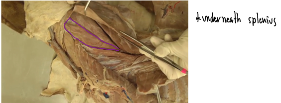 <p>Epaxial Muscles (Neck region)</p><p>(Innervated by dorsal branches of spinal nerves)</p>