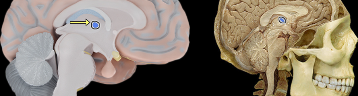 <p>Interthalamic adhesion</p>