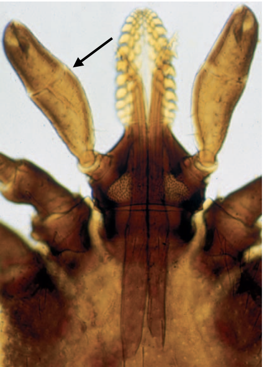 identify the pointed structure