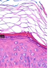 <p>De epidermis bestaat uit meerlagig verhoornd plaveiselepitheel. Die bestaat uit meerdere lagen. Welke? en Hoe kun je het herkennen?</p><p>(onderste laag zie je niet goed op afbeelding) 4 lagen totaal</p>