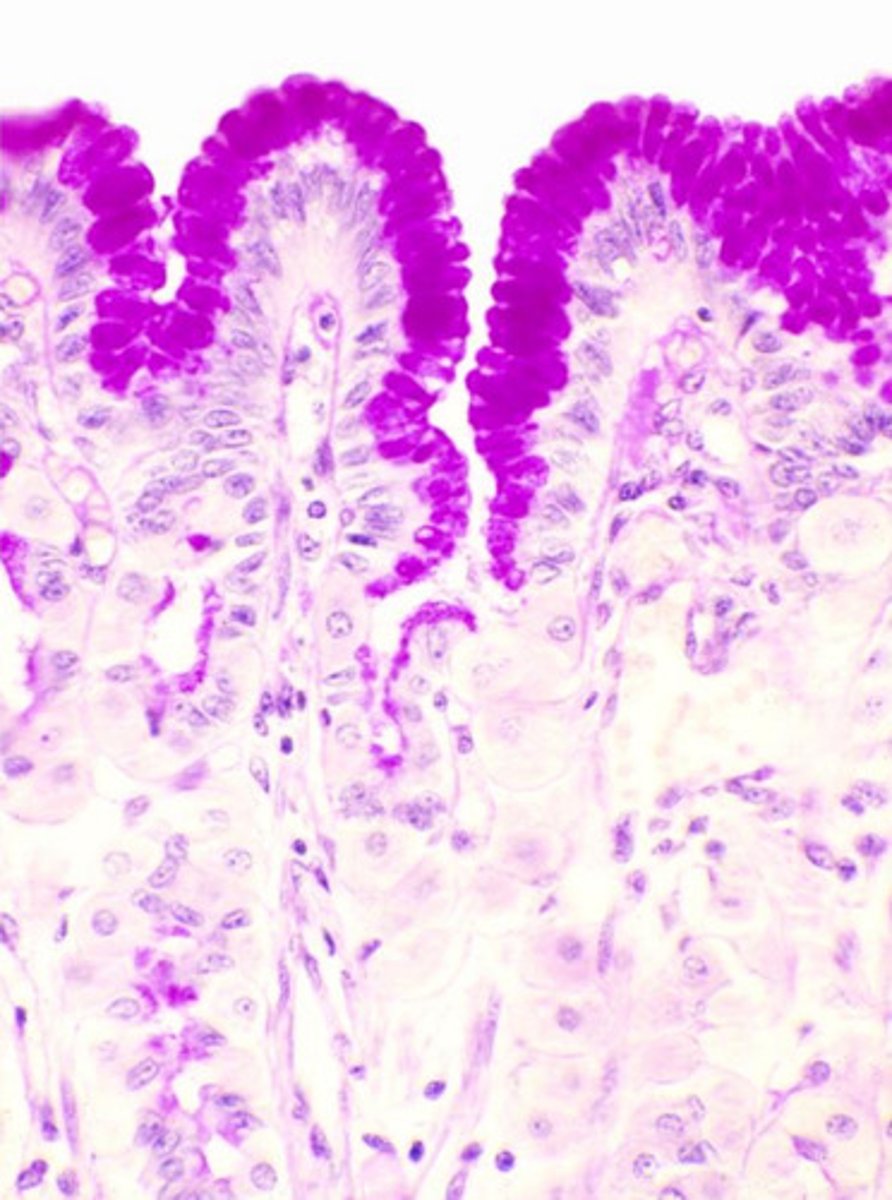 <p>surface mucous cells</p>
