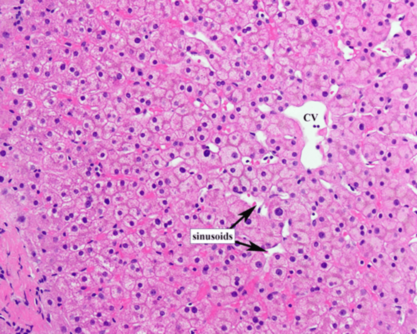 <p>Fenestrated means the endothelial cells have small pores, facilitating filtration—an essential liver function.</p><p>Endothelial cells lining sinusoids have large fenestrations without diaphragm and lack basal lamina, allowing for efficient exchange between the blood and liver cells.</p>