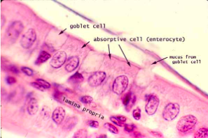 <p>simple columnar absorptive cells</p>