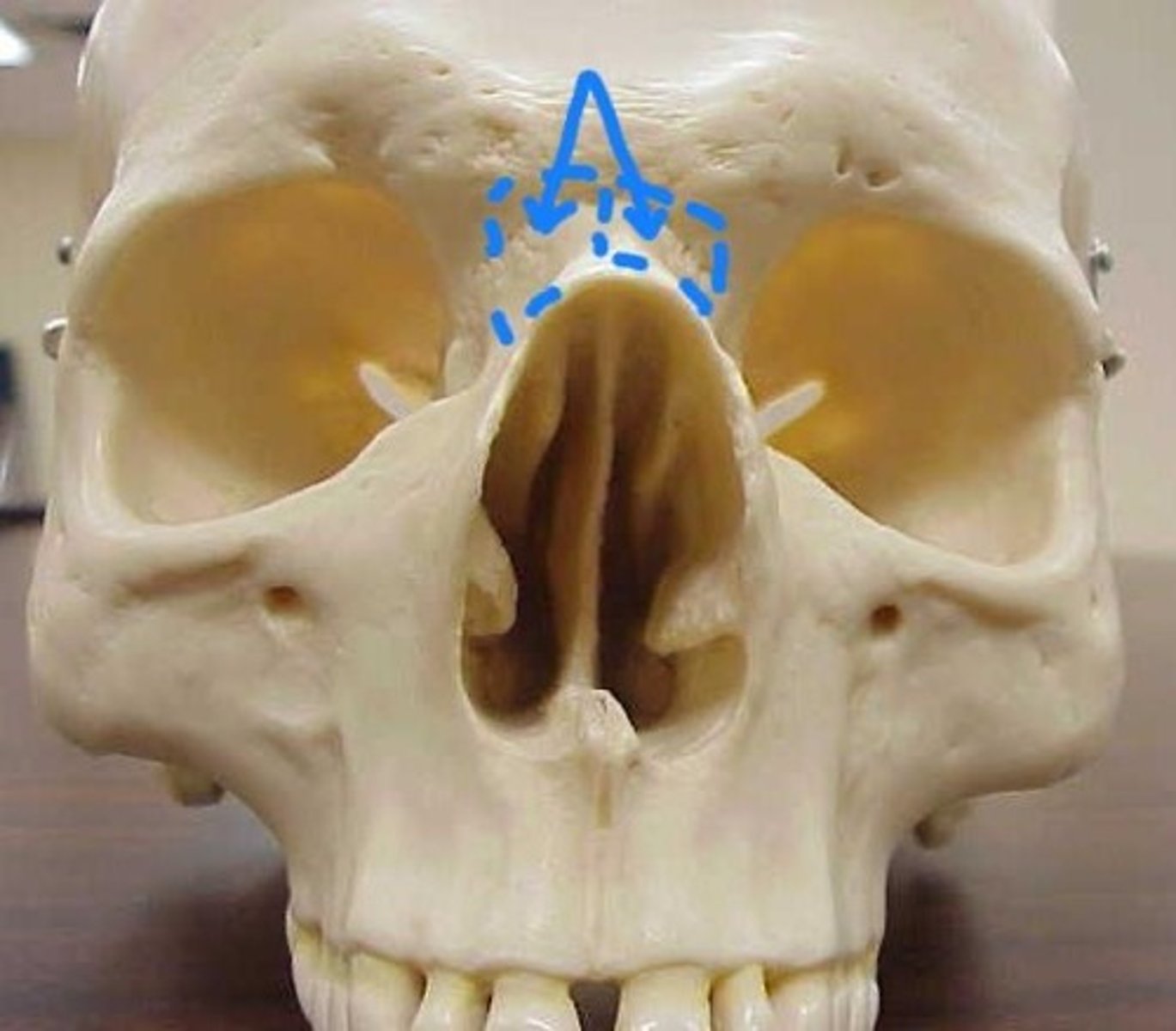 knowt flashcard image
