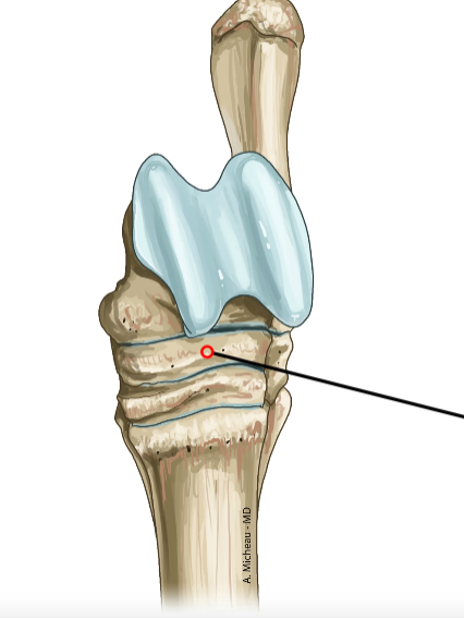<p>Central tarsal bone; connects proximal and distal rows.</p>