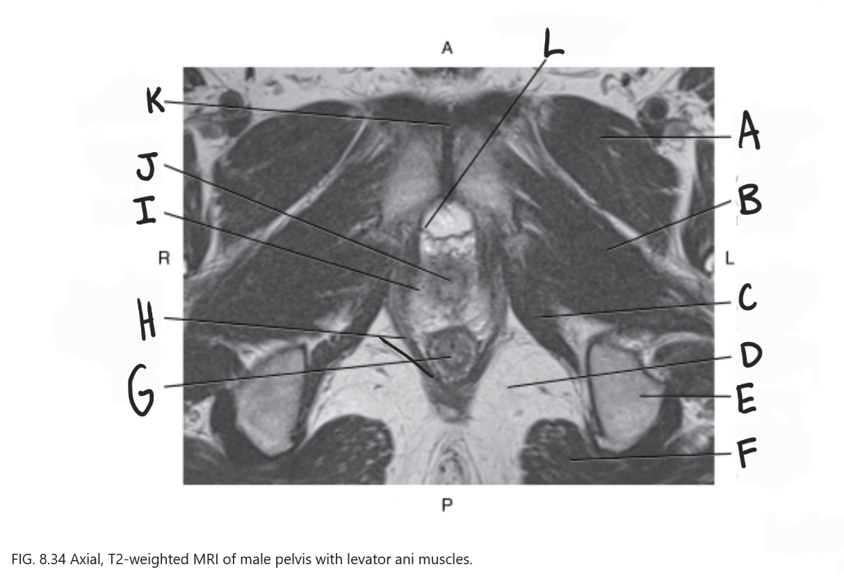 <p>What is K</p>