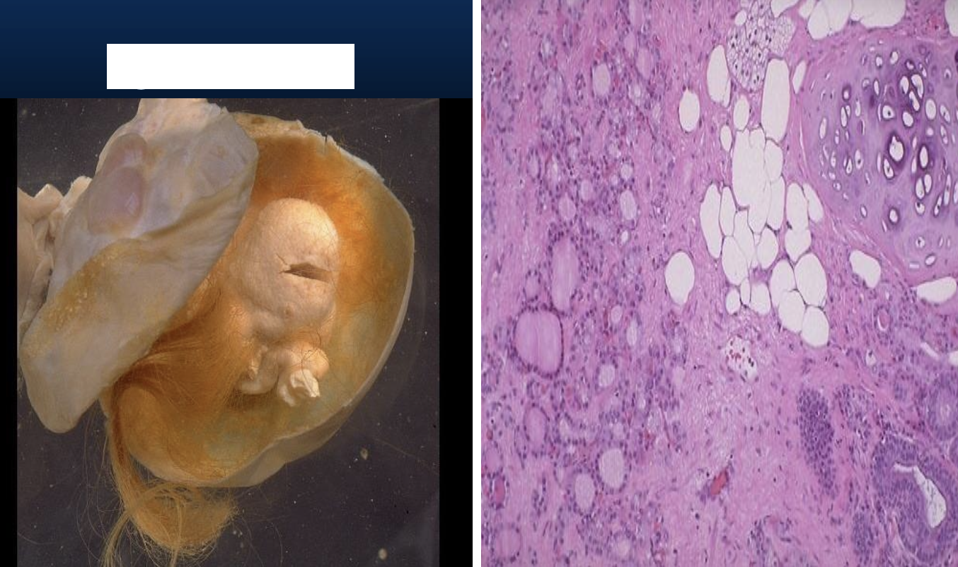 <p>Identify the <strong>organ</strong> and the <strong>diagnosis</strong> in this format: <em>diagnosis, organ</em></p>