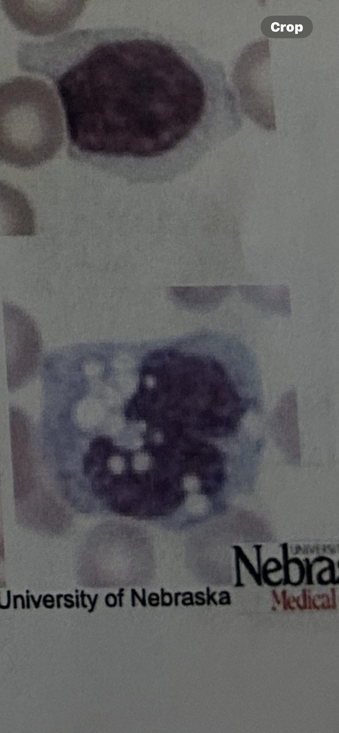 <p>WBC?</p>