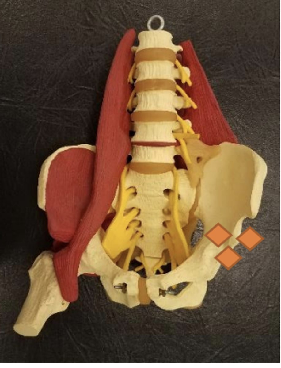 <p>medial to AIIS</p>