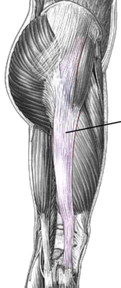 <p>Which tendon of the femur is:</p><ul><li><p>Long tendon to lateral condyle of tibia</p></li><li><p>Action: prevents collapse of ext knee (locks knee)</p><p>Nerve: superior gluteal</p></li></ul><p></p>