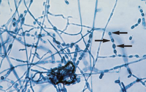 <p>Coccidioides spp.</p>