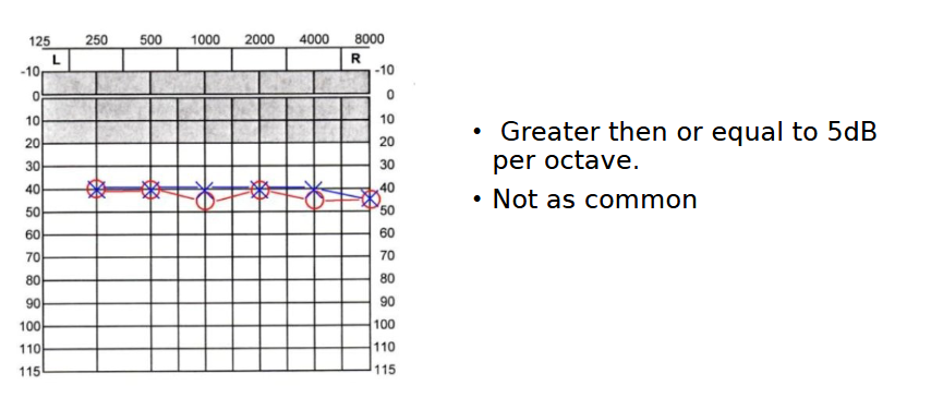 <p>“Mild flat hearing loss”</p>