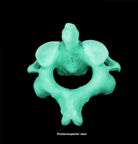 has dens (odontoid process) for head rotation
