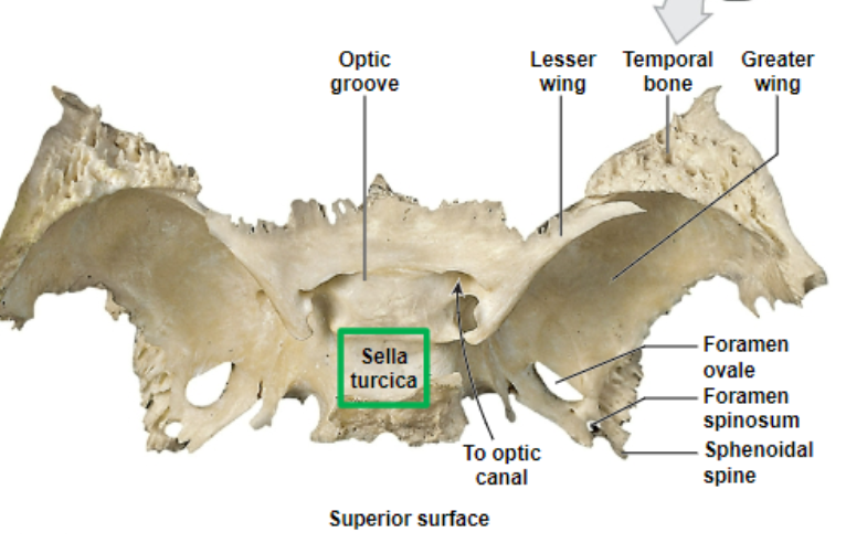 <p>the most structurally complex and intricate bone of the entire body and is where the <span style="color: red"><strong><u>s</u></strong></span><u>ella</u> turcica is</p>