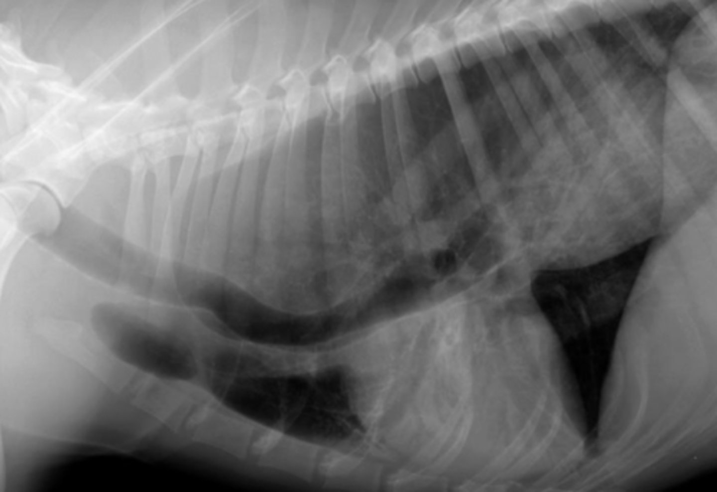 <p>Patient with vomiting and regurgitation shows this radiograph- what do you see?</p>