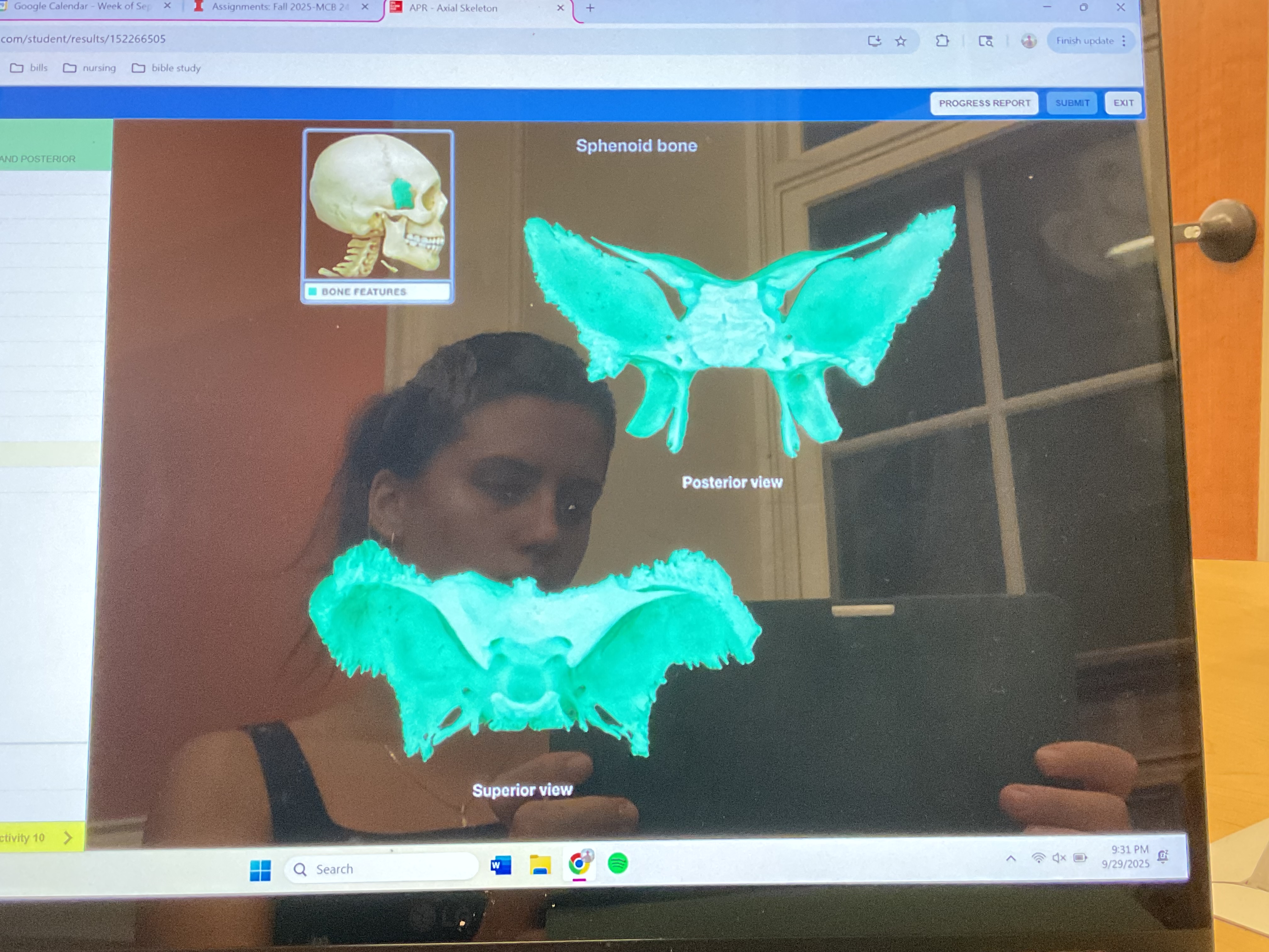 <p>Sphenoid bone </p>