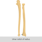 <p>notch on the radius by the carpals (points towards the medial&nbsp; line in anatomical position)</p>