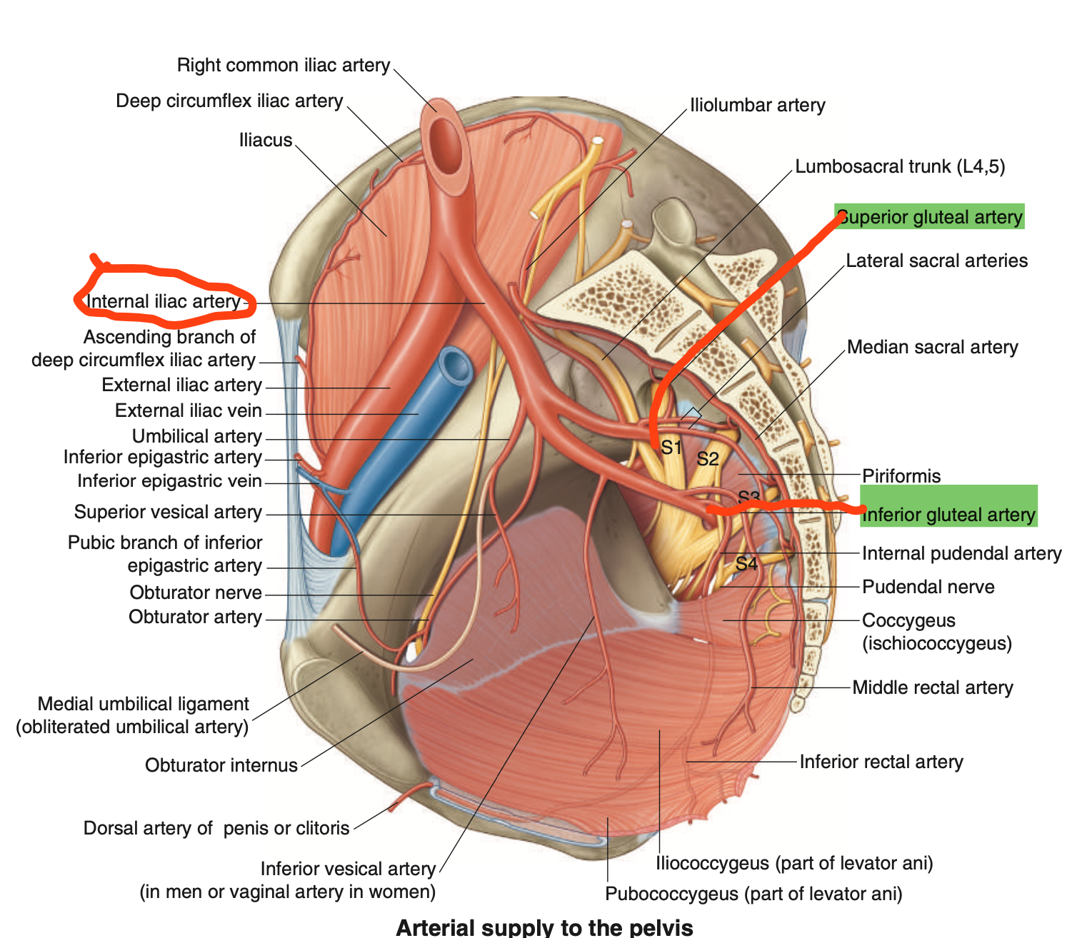 <p>Internal Iliac Artery </p>