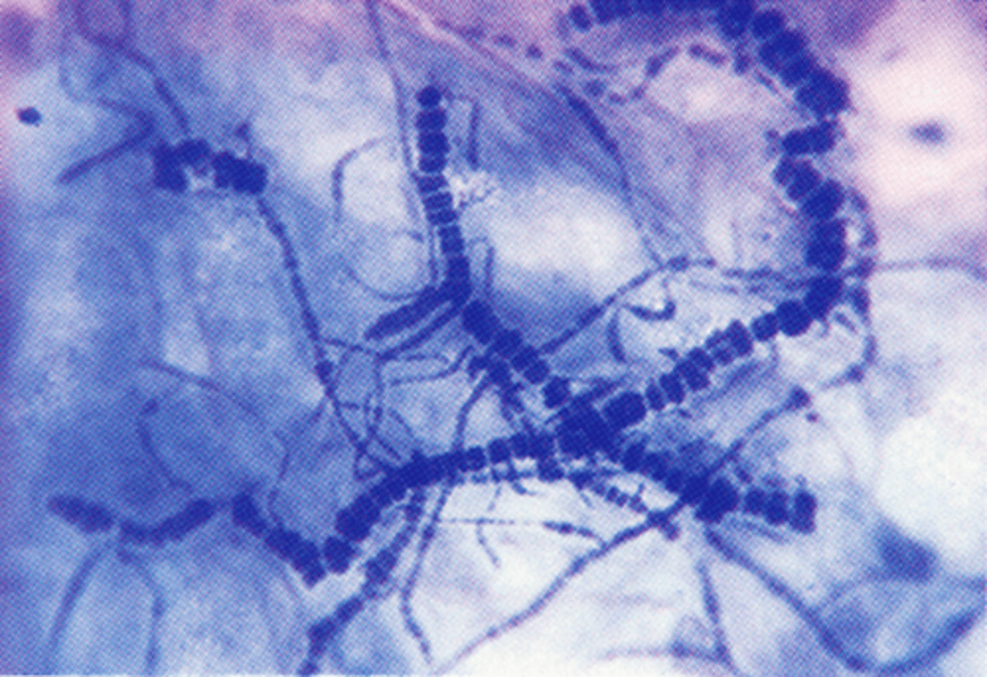 <p>How do you diagnose dermatophilosis?</p>