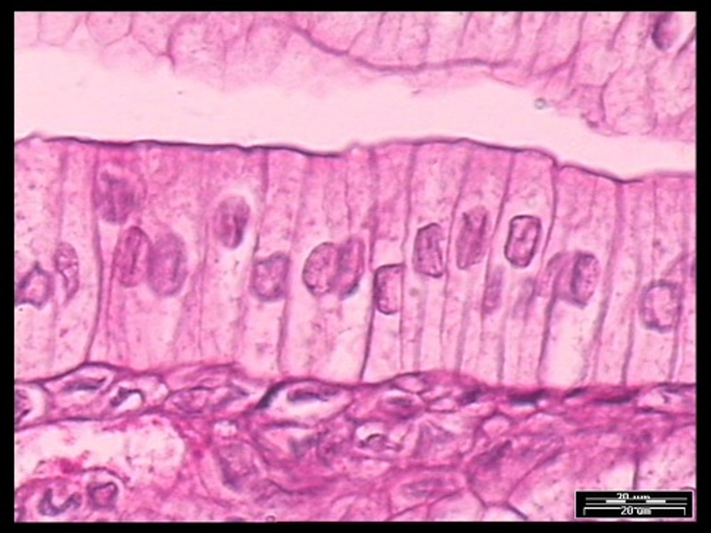 <p>Function - Absorption. Secretion of mucus, enzymes, and other substances. Ciliated type propels mucus by ciliary actions</p><p>Location - Nonciliated type line digestive tract. Ciliated type lines small bronchi, uterine tubes.</p>