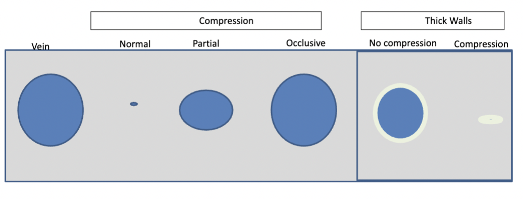 <p>How would you asses vein patentcy through compressions</p>