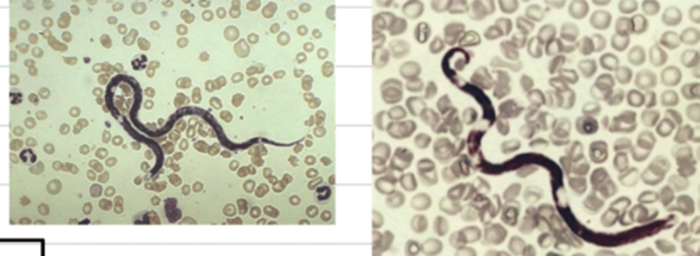 <p>what is this? to what parasite can it belong to?</p>