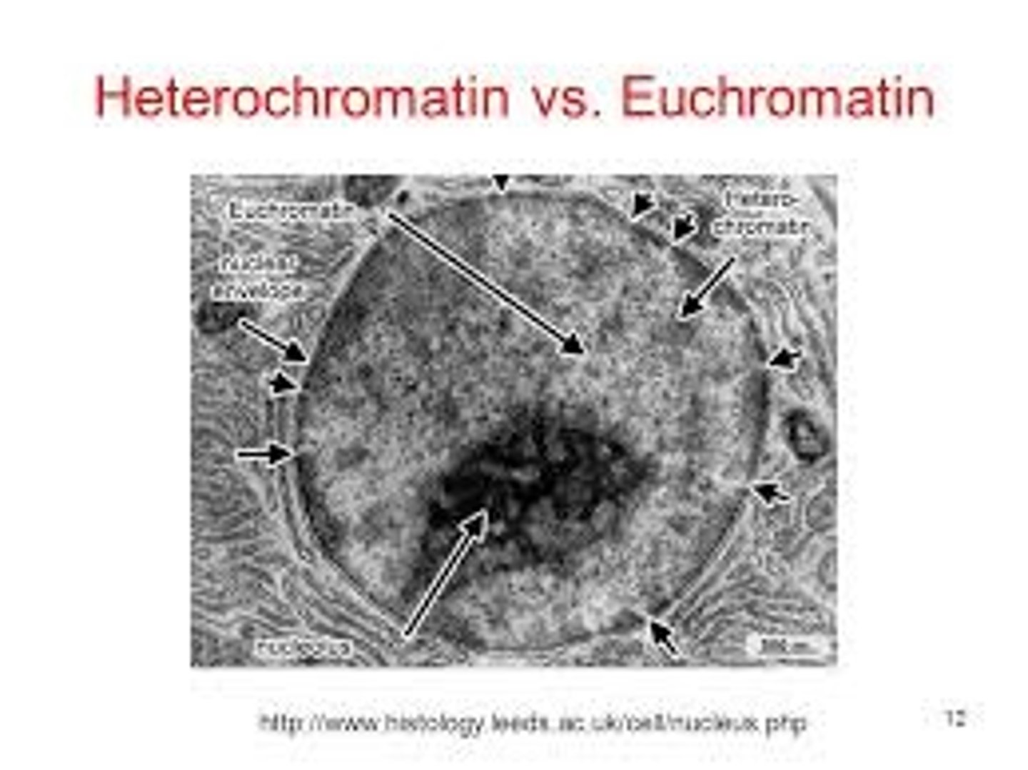 <p>The dark spots are heterochromatin because they are more dense. The light spots are euchromatin becuase they are less dense.</p>