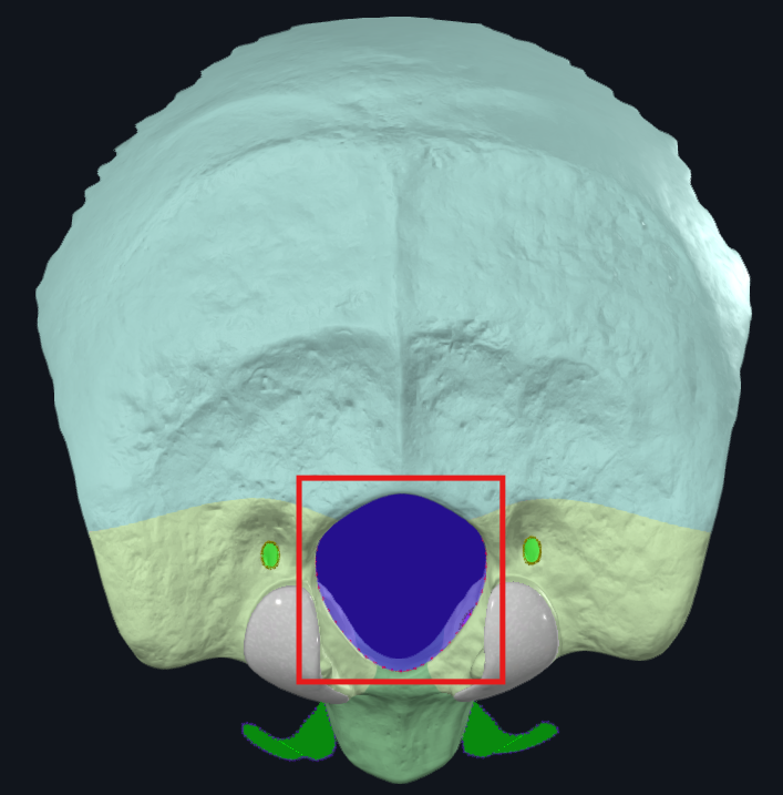 term image